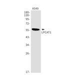 LPCAT1 Recombinant Rabbit Monoclonal Antibody (K01_1T53)