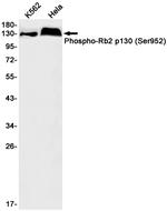 Phospho-p130 (Ser952) Antibody in Western Blot (WB)