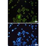 SLC27A4 Recombinant Rabbit Monoclonal Antibody (K01_1Y48)