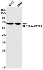 SLC27A4 Antibody in Western Blot (WB)