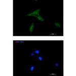 NDUFAF1 Antibody in Immunocytochemistry (ICC/IF)