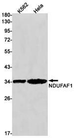 NDUFAF1 Antibody in Western Blot (WB)