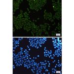 IKK gamma Recombinant Rabbit Monoclonal Antibody (K01_1S82)
