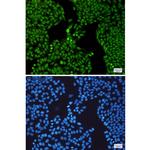 SF3B3 Recombinant Rabbit Monoclonal Antibody (K01_1Y30)