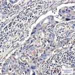 Destrin Recombinant Rabbit Monoclonal Antibody (K01_1Q35)