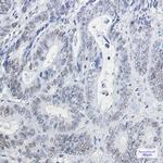 HP1 gamma Recombinant Rabbit Monoclonal Antibody (K01_1S47)