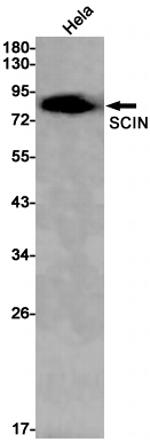 SCIN Antibody in Western Blot (WB)