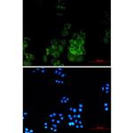 SNX9 Recombinant Rabbit Monoclonal Antibody (K01_1Y35)