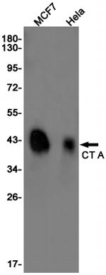 PCYT1A Recombinant Rabbit Monoclonal Antibody (K01_1P86)