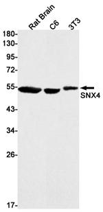 SNX4 Recombinant Rabbit Monoclonal Antibody (K01_1Y62)