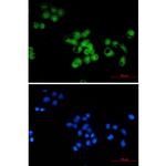 SKP1 Recombinant Rabbit Monoclonal Antibody (K01_1Y44)