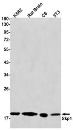 SKP1 Antibody in Western Blot (WB)