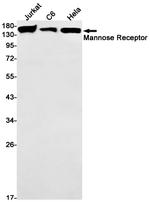 CD206 Recombinant Rabbit Monoclonal Antibody (K01_1T61)