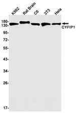 CYFIP1 Recombinant Rabbit Monoclonal Antibody (K01_1Q08)