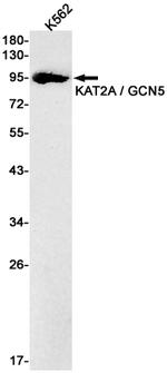 GCN5 Antibody in Western Blot (WB)
