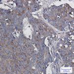 RAC3 Antibody in Immunohistochemistry (Paraffin) (IHC (P))