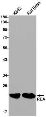 RAC3 Antibody in Western Blot (WB)