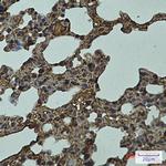 LYVE1 Recombinant Rabbit Monoclonal Antibody (K01_1T58)