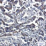 PRDX5 Recombinant Rabbit Monoclonal Antibody (K01_1W62)