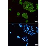 TPT1 Recombinant Rabbit Monoclonal Antibody (K01_2J15)