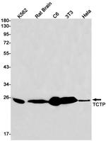 TPT1 Antibody in Western Blot (WB)