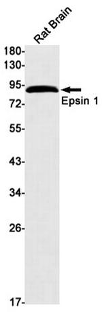 Epsin 1 Antibody in Western Blot (WB)