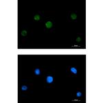 RAVER2 Recombinant Rabbit Monoclonal Antibody (K01_1X64)