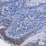 RAVER2 Antibody in Immunohistochemistry (Paraffin) (IHC (P))