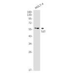 TdT Recombinant Rabbit Monoclonal Antibody (K01_2J18)