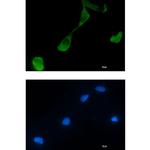 GFPT2 Recombinant Rabbit Monoclonal Antibody (K01_1R65)