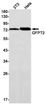 GFPT2 Antibody in Western Blot (WB)