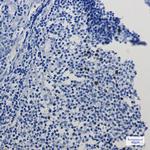 Cyclin A2 Antibody in Immunohistochemistry (Paraffin) (IHC (P))