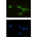 FRAT1 Recombinant Rabbit Monoclonal Antibody (K01_1R36)