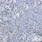 RDBP Recombinant Rabbit Monoclonal Antibody (K01_1U65)