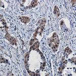 ROC1 Antibody in Immunohistochemistry (Paraffin) (IHC (P))