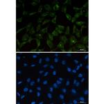 PUMA alpha Recombinant Rabbit Monoclonal Antibody (K01_1X35)
