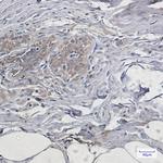 PUMA alpha Antibody in Immunohistochemistry (Paraffin) (IHC (P))