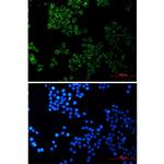 SESN2 Recombinant Rabbit Monoclonal Antibody (K01_1Y27)