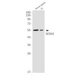 SESN2 Antibody in Western Blot (WB)