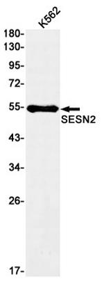 SESN2 Antibody in Western Blot (WB)