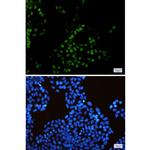 KIFC1 Recombinant Rabbit Monoclonal Antibody (K01_1T28)