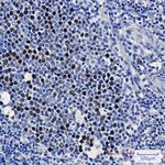 KIFC1 Antibody in Immunohistochemistry (Paraffin) (IHC (P))