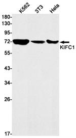 KIFC1 Antibody in Western Blot (WB)