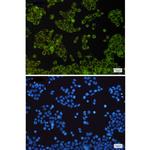 NDUFB9 Recombinant Rabbit Monoclonal Antibody (K01_1U55)