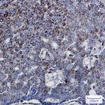 DCI Recombinant Rabbit Monoclonal Antibody (K01_1Q28)