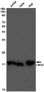 LMO2 Recombinant Rabbit Monoclonal Antibody (K01_1T50)