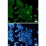 PP1 beta Recombinant Rabbit Monoclonal Antibody (K01_1X02)