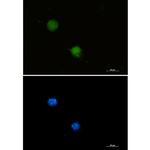 FUBP1 Recombinant Rabbit Monoclonal Antibody (K01_1R40)