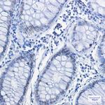 FUBP1 Antibody in Immunohistochemistry (Paraffin) (IHC (P))