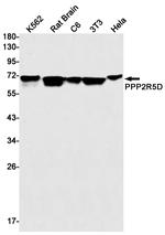 PPP2R5D Recombinant Rabbit Monoclonal Antibody (K01_1X03)